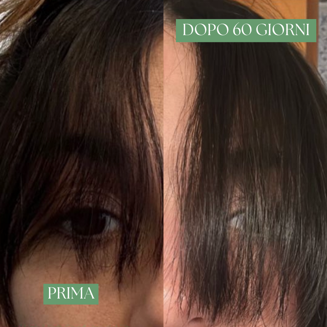 Rosmhair Oil – Trattamento Rinforzante e anticaduta per capelli e cuoio capelluto