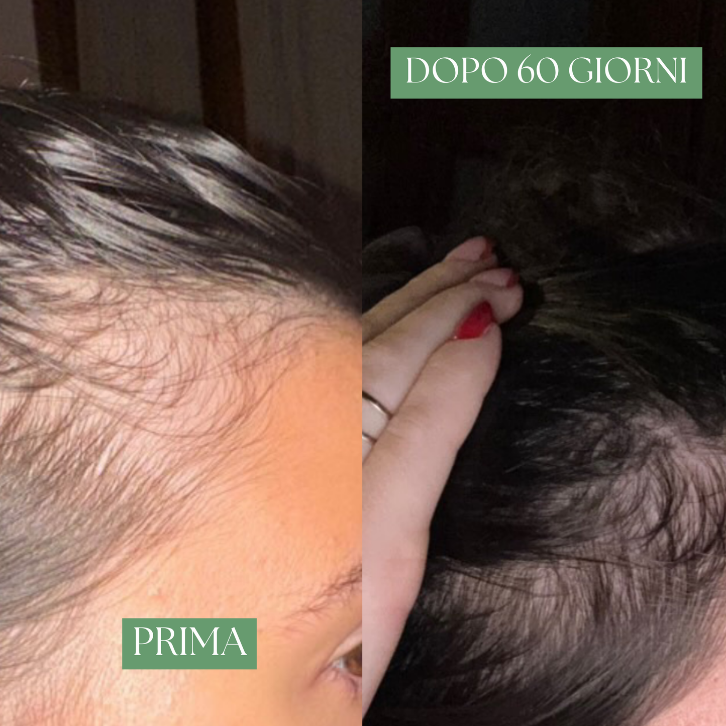 Rosmhair Oil Trattamento 6 mesi - rinforzante e anticaduta per capelli e cuoio capelluto