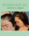 Rosmhair oil - hair oil